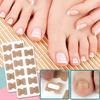 Last Day 50% OFF | PediPatch™ Nail Correction Patches (100 pieces)