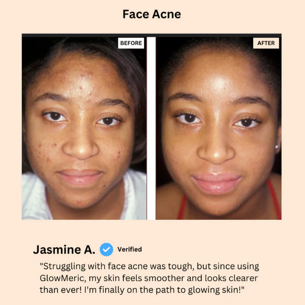 1+1 FREE🔥 I GlowMeric™ Brightening Turmeric Soap