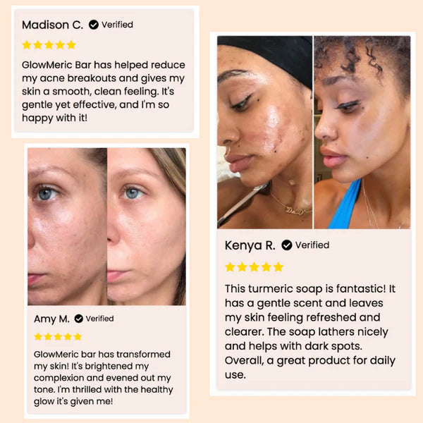 1+1 FREE🔥 I GlowMeric™ Brightening Turmeric Soap