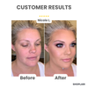 Last Day – 50% Off | GlowEase™ 3-in-1 Perfecting Skin Cream