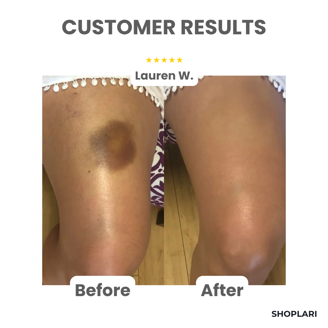 Last Day – 50% Off | GlowEase™ 3-in-1 Perfecting Skin Cream