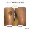 Last Day – 50% Off | GlowEase™ 3-in-1 Perfecting Skin Cream