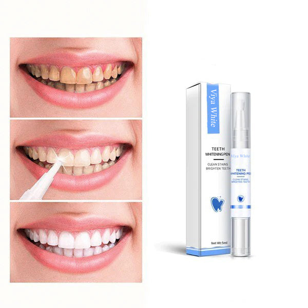 50% OFF🔥 I GlowDent™ Teeth Whitening Pen