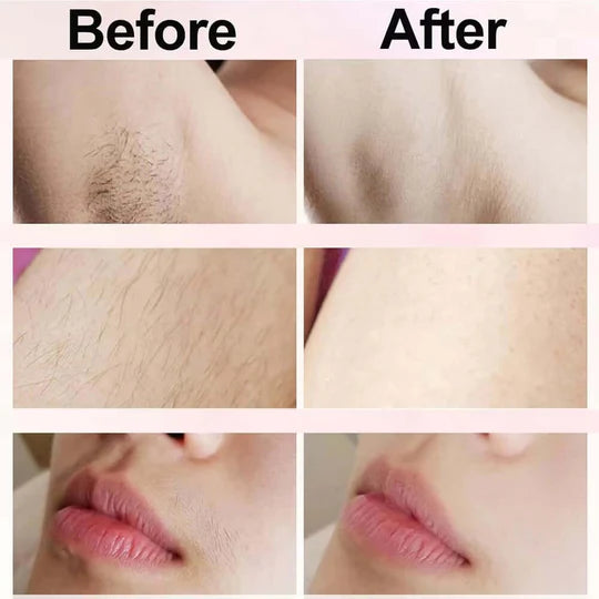 SilkiSkin™ Shaver
