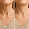 VelvaLift™ Face Neck Lifting Tape