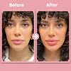 LipBloom™ Lip Lift Roller Kit
