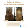 50% OFF🔥 I HairGlow™ Magical Hair Treatment