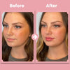 LipBloom™ Lip Lift Roller Kit