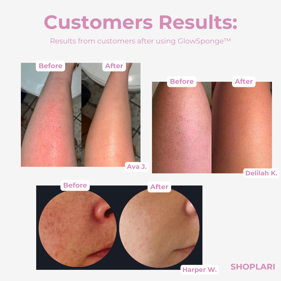 Last Day 1+2 FREE🔥 | GlowSponge™ Body Scrub Sponge