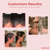 50% OFF🔥 I LumaGrow™ Scalp Massager