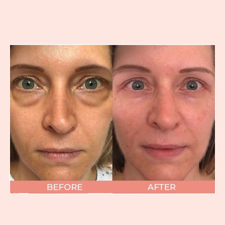 Retinol Eye Cream Stick🔥