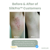 Last Day 50% OFF I SilkPro™ Hair Removal Spray