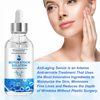 SkinRenew™ Anti Aging Serum