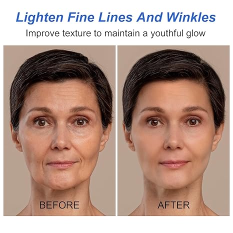 SkinRenew™ Anti Aging Serum