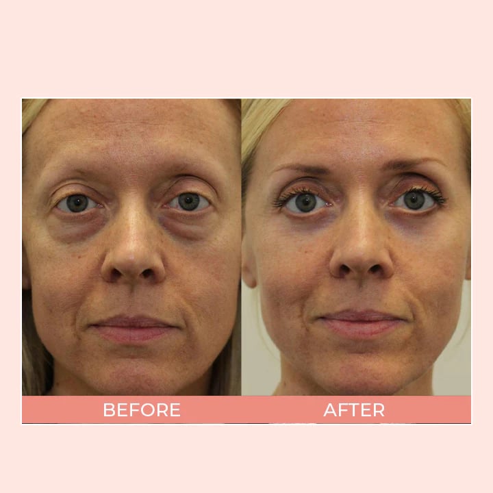 Retinol Eye Cream Stick🔥