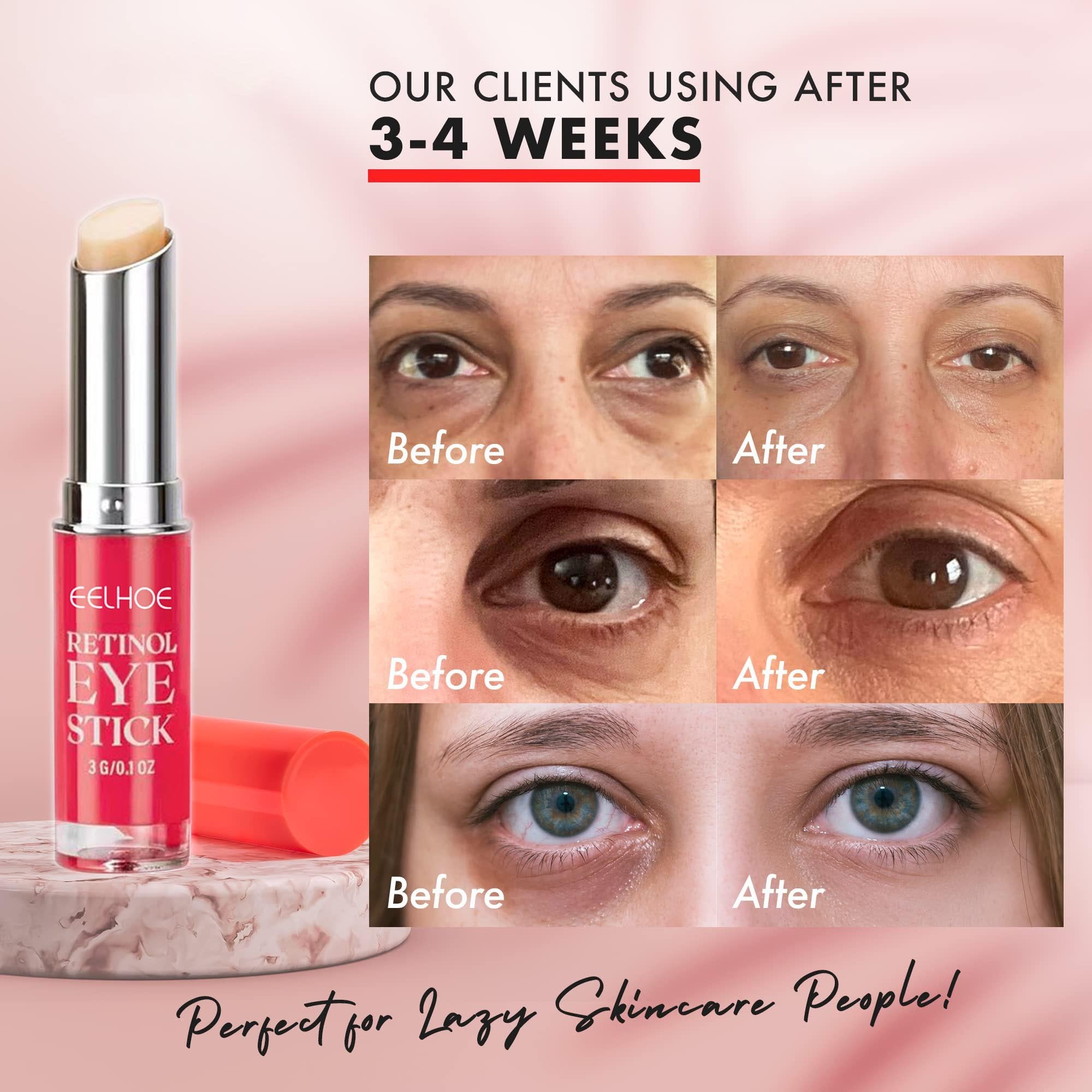 Retinol Eye Cream Stick🔥