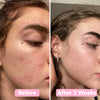 GlowKlear™ Turmeric & Kojic Foaming Cleanser