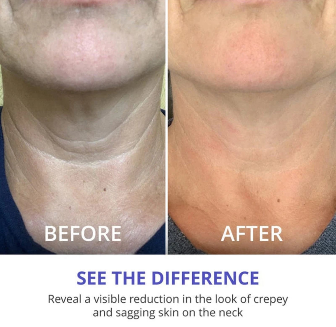 GoPure™ Skincare