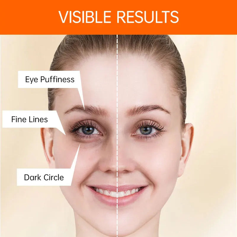 EyeBrillianc™ Anti Wrinkle Cream