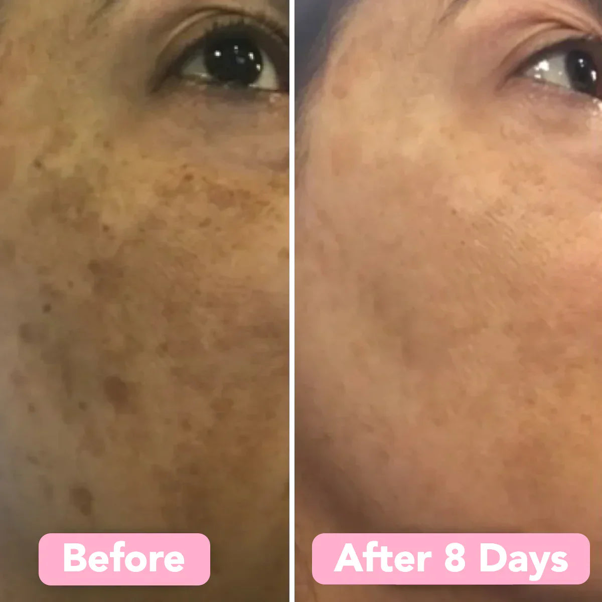 GlowKlear™ Turmeric & Kojic Foaming Cleanser