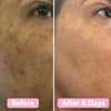 GlowKlear™ Turmeric & Kojic Foaming Cleanser