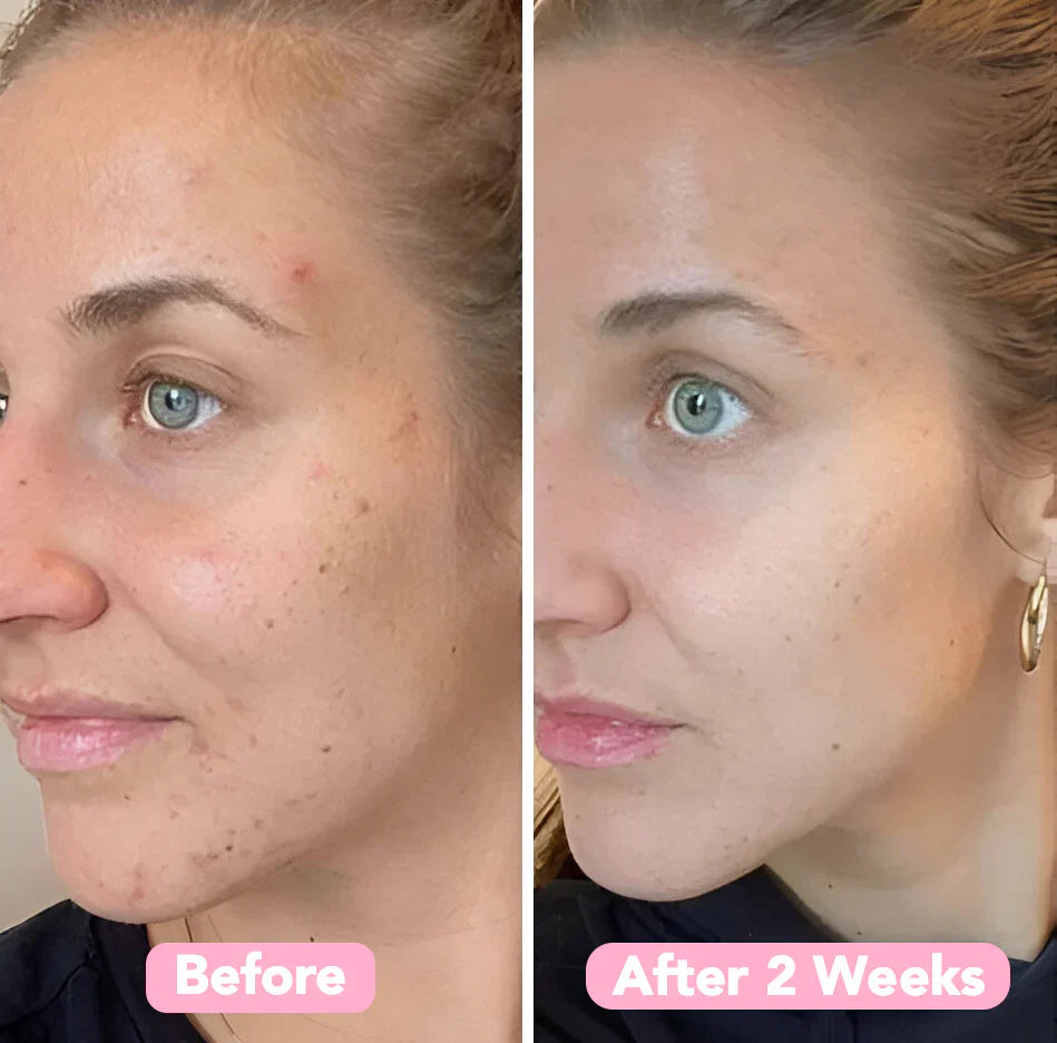 GlowKlear™ Turmeric & Kojic Foaming Cleanser