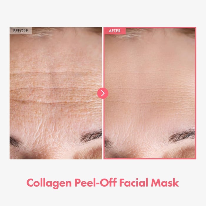 SkinLift™ Collagen Mask