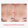 SkinLift™ Collagen Mask