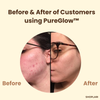 Last Day 1+1 FREE | PureGlow™ Black Tea Mask