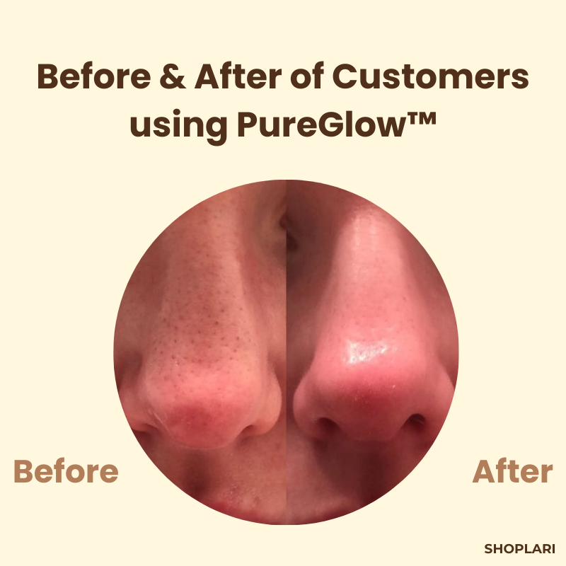 Last Day 1+1 FREE | PureGlow™ Black Tea Mask