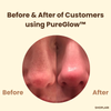 Last Day 1+1 FREE | PureGlow™ Black Tea Mask