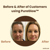 Last Day 1+1 FREE | PureGlow™ Black Tea Mask