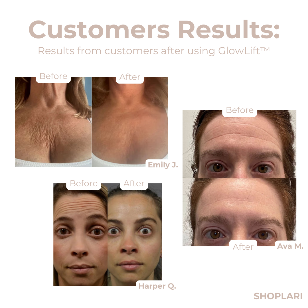 50% OFF🔥 I GlowLift™ Anti-Wrinkle Silicone Patches