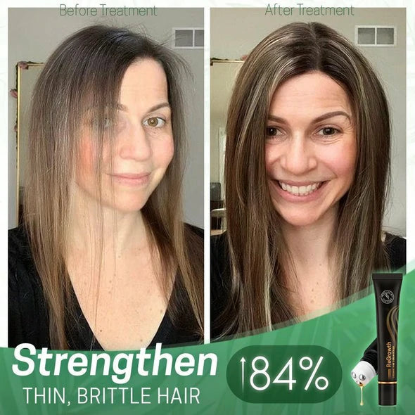 FollicaGrow™ Hair Serum Roller